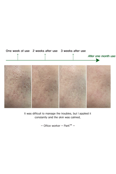 EYENLIP - AC Clear Spot 1g+1g *5pcs