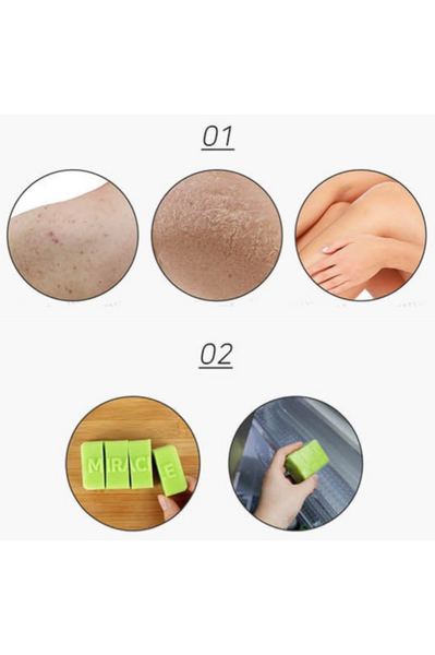 SOME BY MI - AHA, BHA, PHA 30 Days Miracle Cleansing Bar 106g